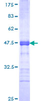 SDS-PAGE - Recombinant Human BORIS protein (AB112433)