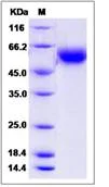 SDS-PAGE - Recombinant Human BPIFB1 protein (His tag) (AB276525)
