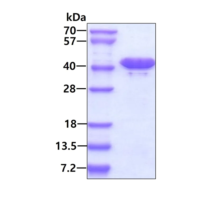 SDS-PAGE - Recombinant Human BPNT1 protein (AB103057)