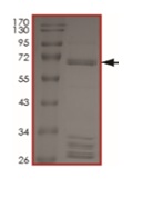SDS-PAGE - Recombinant human BRAF (mutated V600K) protein (AB204191), expandable thumbnail