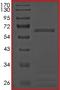 Recombinant human BRAF protein