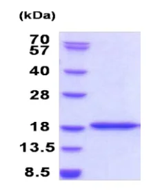 SDS-PAGE - Recombinant Human BRD1/BRL protein (His tag N-Terminus) (AB187427)