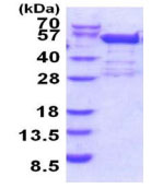 SDS-PAGE - Recombinant Human BRD2 protein (AB187435), expandable thumbnail