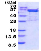 SDS-PAGE - Recombinant Human BRD2 protein (AB187435)