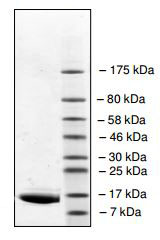 SDS-PAGE - Recombinant human BRD2 protein (AB196109), expandable thumbnail