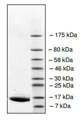 SDS-PAGE - Recombinant human BRD2 protein (His tag N-Terminus) (AB196109)