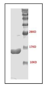 SDS-PAGE - Recombinant Human Brd4 protein (AB176936), expandable thumbnail
