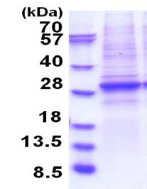SDS-PAGE - Recombinant Human BRG1 protein (denatured) (AB183264)
