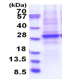 SDS-PAGE - Recombinant Human BRG1 protein (denatured) (AB183264)