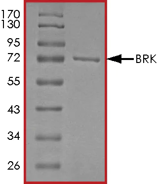 SDS-PAGE - Recombinant human Brk/PTK6 protein (AB60888)