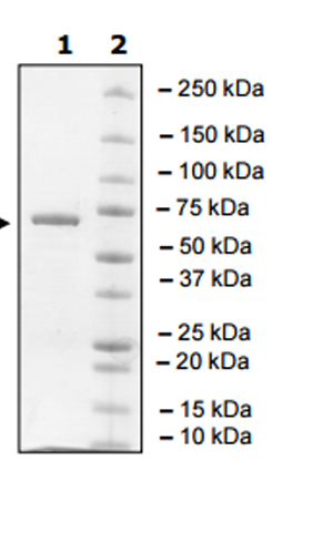 Recombinant human Brk/PTK6 protein (Tagged)