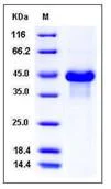 SDS-PAGE - Recombinant Human Brorin protein (His tag) (AB276457)