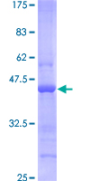 SDS-PAGE - Recombinant Human BST2/Tetherin protein (AB114390)