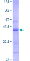 SDS-PAGE - Recombinant Human BST2/Tetherin protein (AB114390)