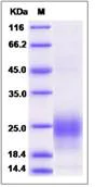 SDS-PAGE - Recombinant Human BST2/Tetherin protein (His tag) (AB276534)