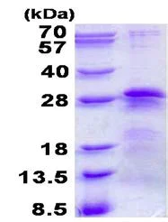 SDS-PAGE - Recombinant Human BTF3 protein (His tag N-Terminus) (AB139205)