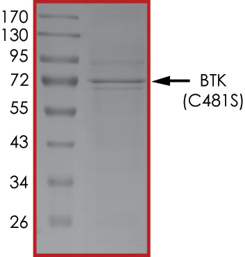 SDS-PAGE - Recombinant human BTK (mutated C481S) protein (AB204166)