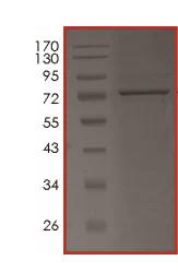 SDS-PAGE - Recombinant human BTK (mutated C481S) protein (AB204166)