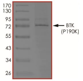 SDS-PAGE - Recombinant human BTK (mutated P190K) protein (Active) (AB268373)