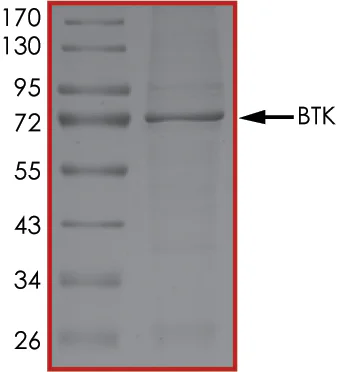 SDS-PAGE - Recombinant human BTK protein (His tag N-Terminus) (AB205800)