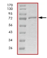 SDS-PAGE - Recombinant human BTK protein (His tag N-Terminus) (AB205800)