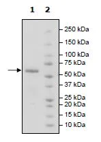 SDS-PAGE - Recombinant Human BTN3A1 protein (Tagged) (AB271422)