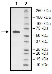 SDS-PAGE - Recombinant Human BTNL8 protein (Avi tag C-Terminus + Fc tag C-Terminus) (AB271394)
