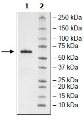 SDS-PAGE - Recombinant Human BTNL8 protein (Tagged) (AB271394)