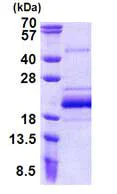 SDS-PAGE - Recombinant Human BUD31 protein (His tag N-Terminus) (AB156741)