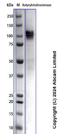 SDS-PAGE - Recombinant Human Butyrylcholinesterase Protein Standard (His tag) (AB322693), expandable thumbnail