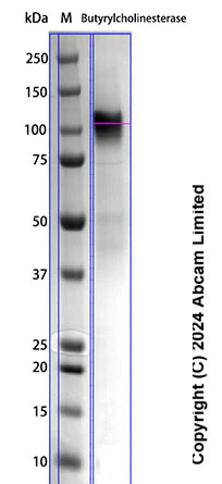 SDS-PAGE - Recombinant Human Butyrylcholinesterase Protein Standard (His tag) (AB322693)