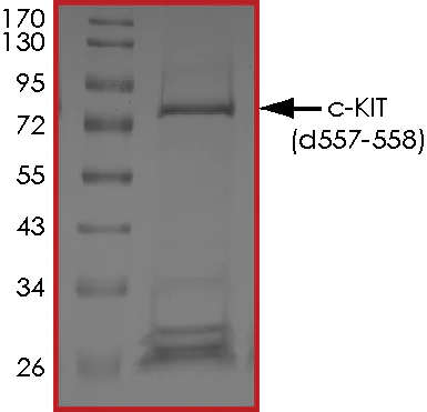 SDS-PAGE - Recombinant human c-Kit deletion 557-558 protein (Active) (AB268410)