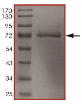 SDS-PAGE - Recombinant human c-Kit (mutated T670E) protein (AB185252), expandable thumbnail