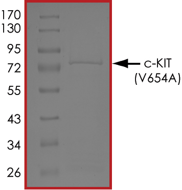 SDS-PAGE - Recombinant human c-Kit (mutated V654A) protein (AB63179), expandable thumbnail