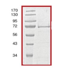 SDS-PAGE - Recombinant human c-Kit (mutated V654A) protein (AB63179), expandable thumbnail