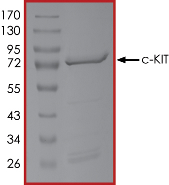 SDS-PAGE - Recombinant human c-Kit protein (AB205798), expandable thumbnail