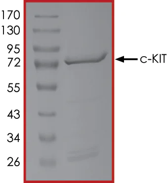 SDS-PAGE - Recombinant human c-Kit protein (AB205798)