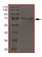 SDS-PAGE - Recombinant human c-Kit protein (AB205798), expandable thumbnail