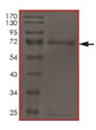 SDS-PAGE - Recombinant human c-Kit protein (AB205798)