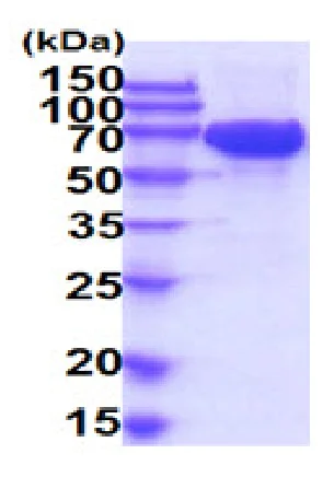SDS-PAGE - Recombinant Human c-Kit protein (His tag) (AB227397)