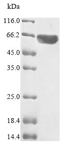 SDS-PAGE - Recombinant Human c-Myc protein (Tagged) (AB235798)