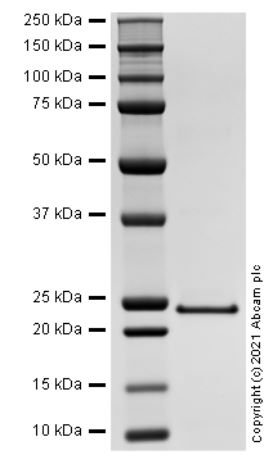 SDS-PAGE - Recombinant Human C-Reactive Protein/CRP Protein (AB283925)