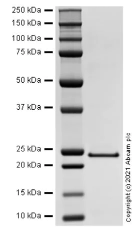 SDS-PAGE - Recombinant Human C-Reactive Protein/CRP Protein (AB283925)