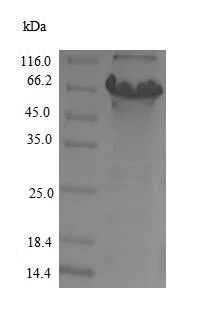 SDS-PAGE - Recombinant Human C11B2/CYP11B2 protein (His tag) (AB224858)