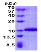 SDS-PAGE - Recombinant Human C11orf79 protein (AB139611)