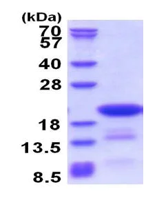SDS-PAGE - Recombinant Human C14orf126 protein (His tag N-Terminus) (AB177665)