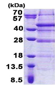 SDS-PAGE - Recombinant Human C17orf81 protein (AB168089)