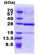 SDS-PAGE - Recombinant Human C19orf50 protein (AB168069)