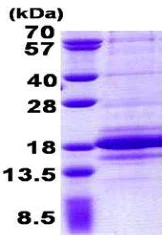 SDS-PAGE - Recombinant Human C1D protein (His tag N-Terminus) (AB156979)