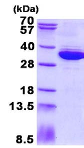 SDS-PAGE - Recombinant Human C1orf33 protein (AB134607)